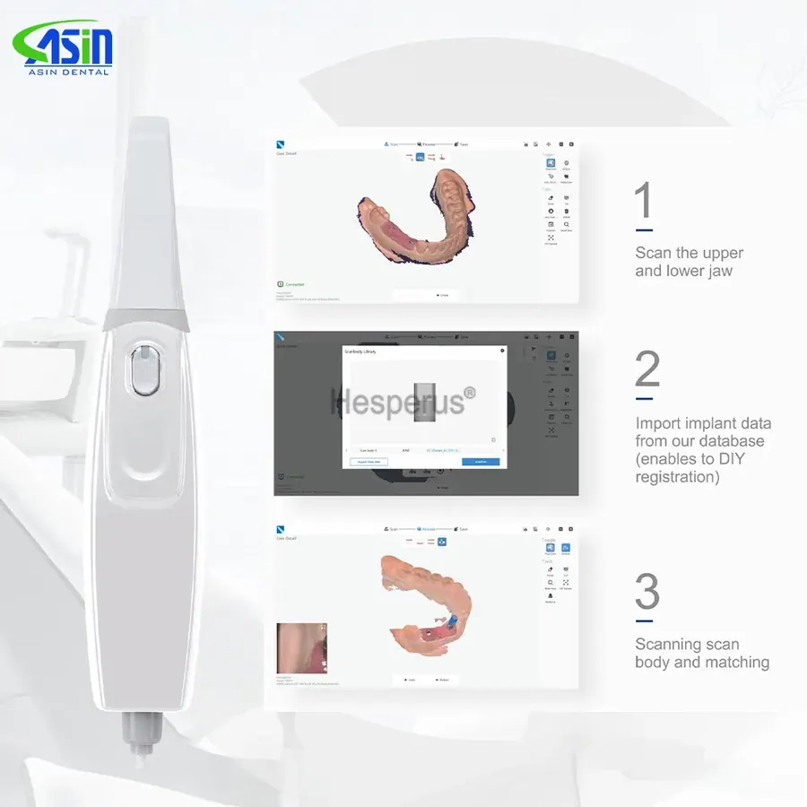 Интраоральный сканер Runyes 3DS V3 PRO